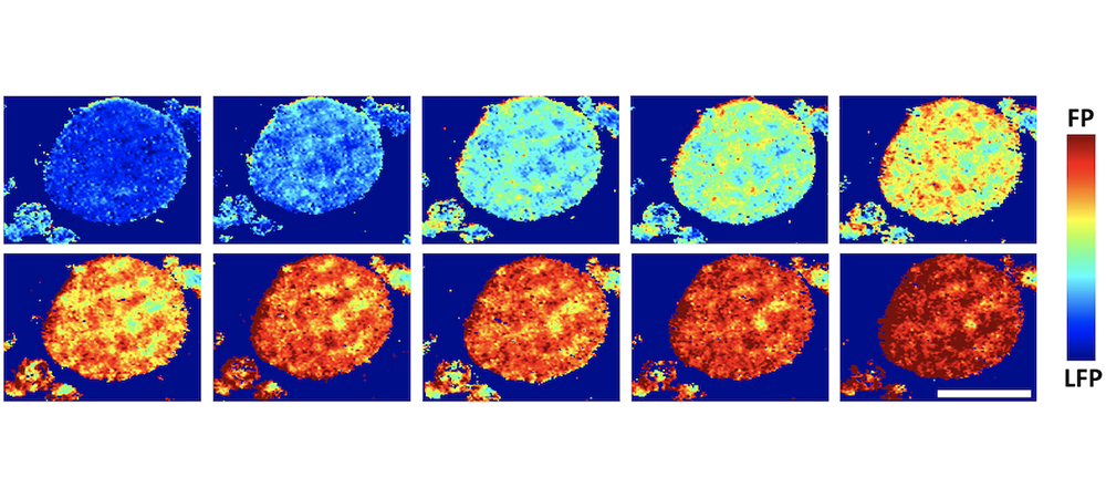 Charged EVs Rice researchers find misaligned crystallites in cathodes